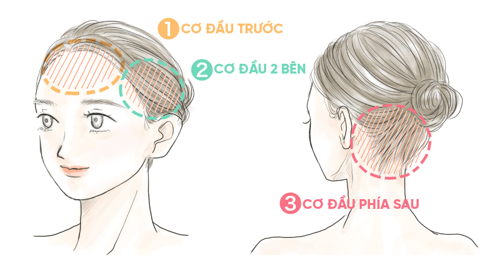 Vấn đề đó có thể là do cơn đau đầu của bạn gây ra.